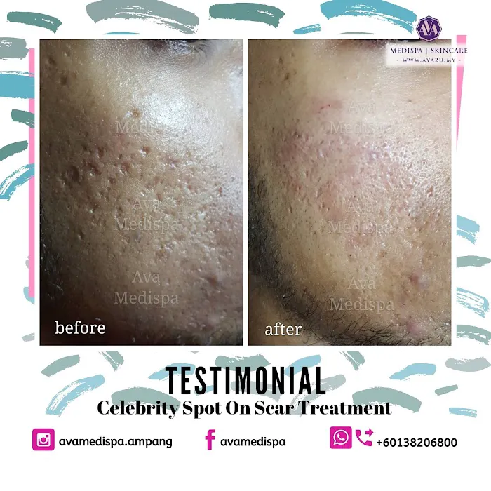 Ava Medispa Ampang Picture 10