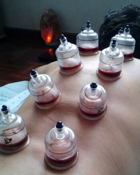 Spa Urut dan Bekam ar-Rifaee Picture 3