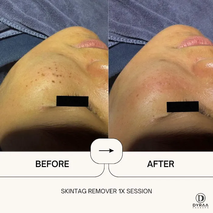 DYRAA FACESPA & HAIRSALON KOTA WARISAN Picture 6