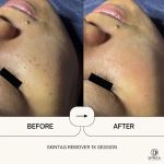 DYRAA FACESPA & HAIRSALON KOTA WARISAN