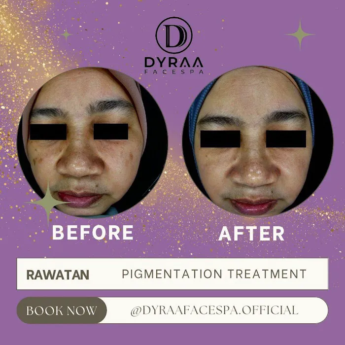DYRAA FACESPA & HAIRSALON KOTA WARISAN Picture 5