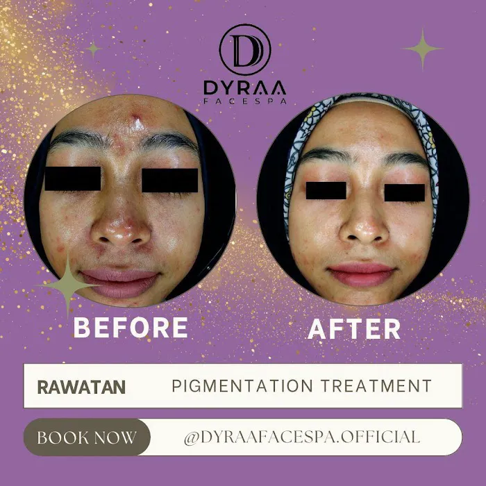 DYRAA FACESPA & HAIRSALON KOTA WARISAN Picture 10