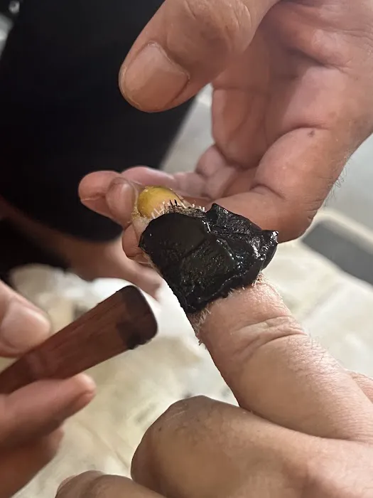 Urut Tradisional, Terseliuh Dan Rawatan Urut Patah Azhar Picture 2