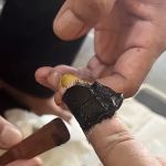 Urut Tradisional, Terseliuh Dan Rawatan Urut Patah Azhar