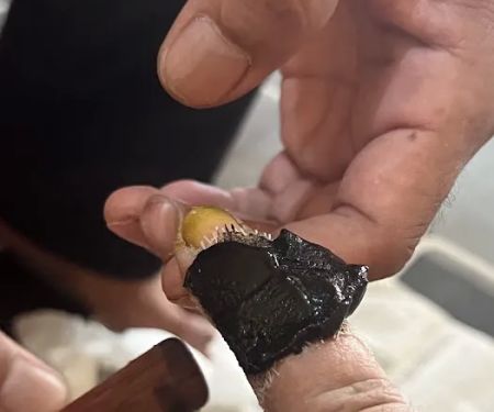 Urut Tradisional, Terseliuh Dan Rawatan Urut Patah Azhar