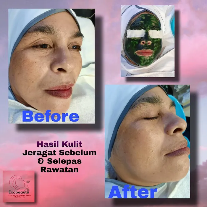DyraDynan ExcBeauty Spa Studio Picture 1