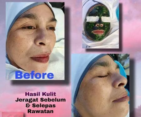 DyraDynan ExcBeauty Spa Studio
