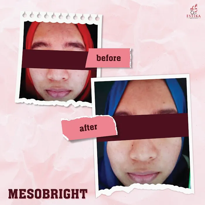 Estika Medispa Semenyih Picture 10