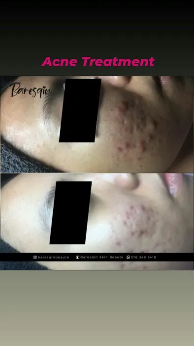 Baresqinbeaute Picture 8