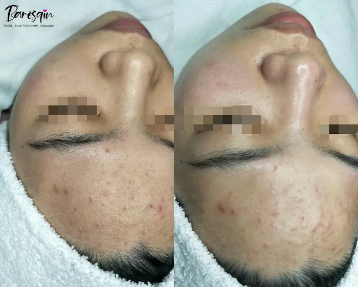 Baresqinbeaute Picture 2